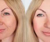 SPONSOR: Get Rid of Moles and Skin Tags Effortlessly — Just Do This!