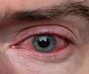 SPONSOR: Are you Wasting Your Money on Eye Drops?