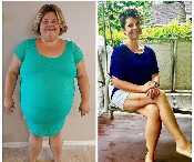 SPONSOR: Cardiologists Reveal Losing a Hanging Tummy Comes Down to This 1 Thing
