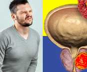 SPONSOR: Urologist: Men 55+ Are Quietly Shrinking Their Clogged Prostate