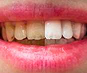 SPONSOR: Try This 60-Second Trick Before Spending $5,000 on Implants