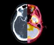 SPONSOR: Popular Drink Linked to Alzheimer’s Disease?